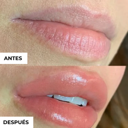 Plumi!®      Labios mas voluminosos en 1 minuto